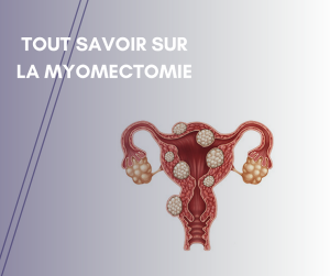 myomectomie