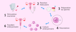 Les étapes de la fécondation in vitro