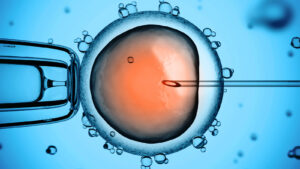 fécondation in vitro icsi