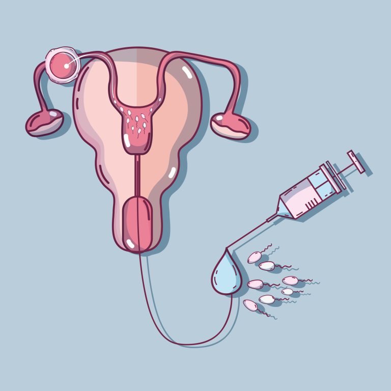 fallopian tubes and artificial insemination process vector illustration