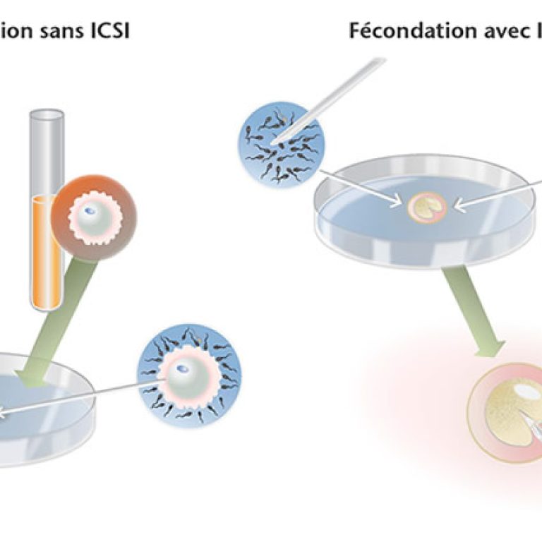 img_procreation-assistee_types-de-fecondations_FR